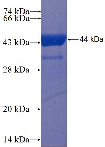 Recombinant Human RABGEF1 SDS-PAGE