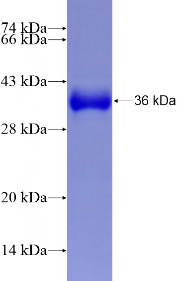 Recombinant Human RSRC2 SDS-PAGE
