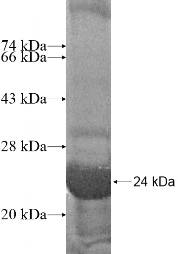 Recombinant Human FAM96B SDS-PAGE