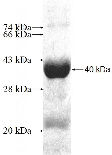Recombinant Human MRPL1 SDS-PAGE