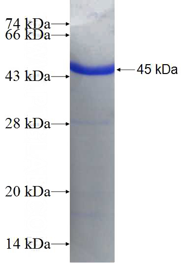 Recombinant Human FIBCD1 SDS-PAGE