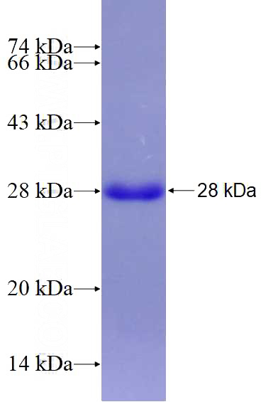 Recombinant Human SLC6A5 SDS-PAGE