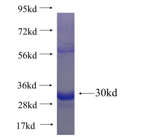 Recombinant human IL1F7(Full length) SDS-PAGE