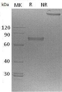 Mouse Ncr1/Ly94 (His tag) recombinant protein