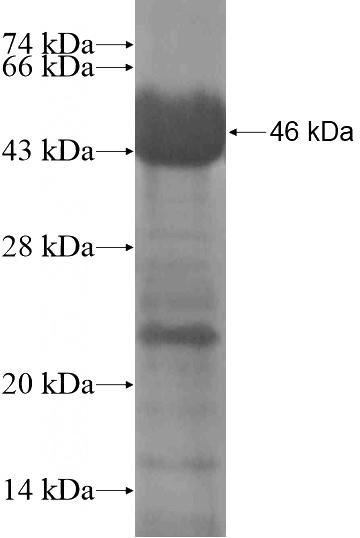 Recombinant Human LGSN SDS-PAGE