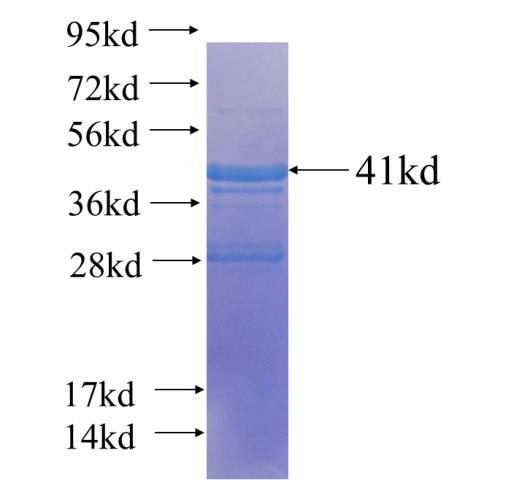 Recombinant human TBP SDS-PAGE
