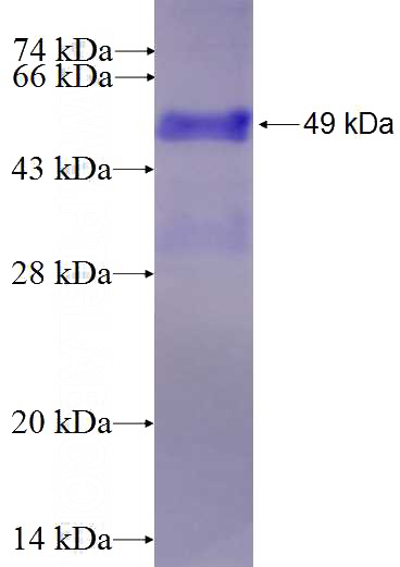 Recombinant Human EIF2AK4 SDS-PAGE