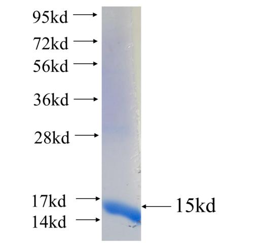 Recombinant human STEAP1 SDS-PAGE