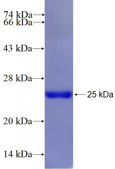 Recombinant Human KIFC2 SDS-PAGE