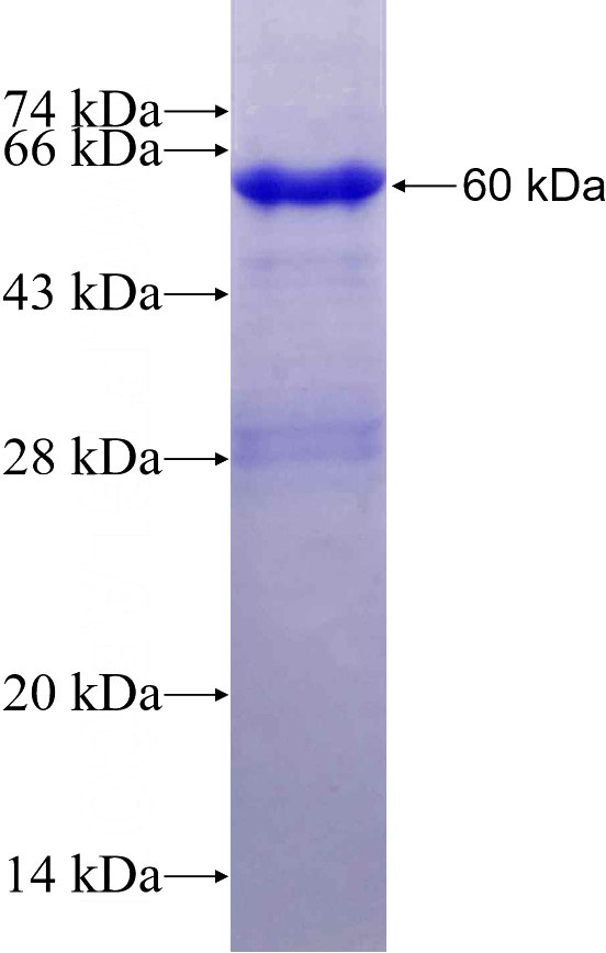 Recombinant Human VPS54 SDS-PAGE
