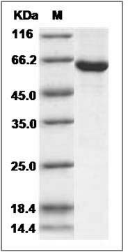 Human SPHK1 / Sphingosine Kinase 1 (His & GST Tag) recombinant protein