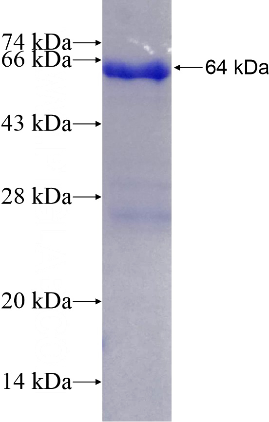 Recombinant Human FMNL1 SDS-PAGE