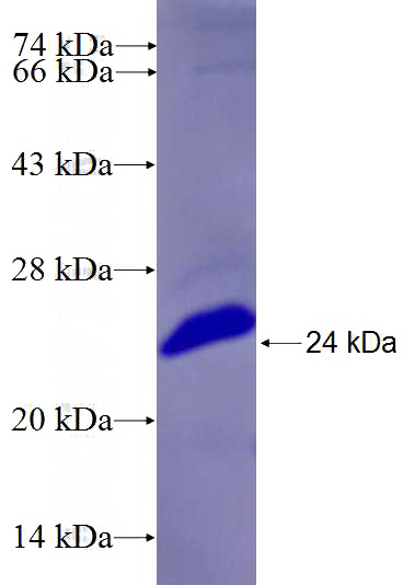 Recombinant Human CDV3 SDS-PAGE