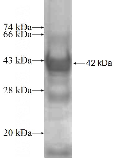 Recombinant Human MYO1B SDS-PAGE
