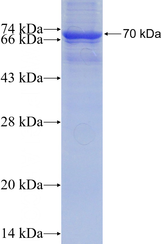 Recombinant Human TXNIP SDS-PAGE