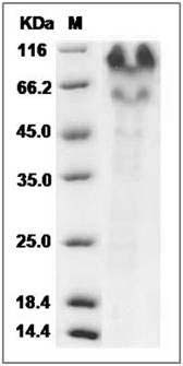 Human PSGL-1 / CD162 / SELPLG Protein (His Tag) SDS-PAGE