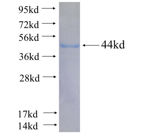 Recombinant human STXBP2 SDS-PAGE