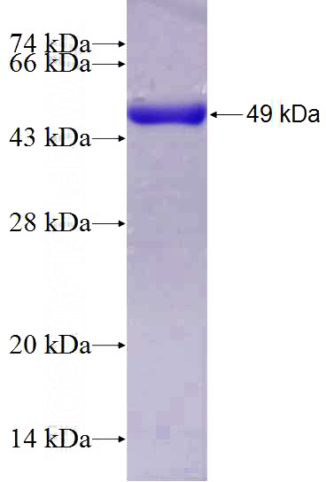 Recombinant Human IKIP SDS-PAGE