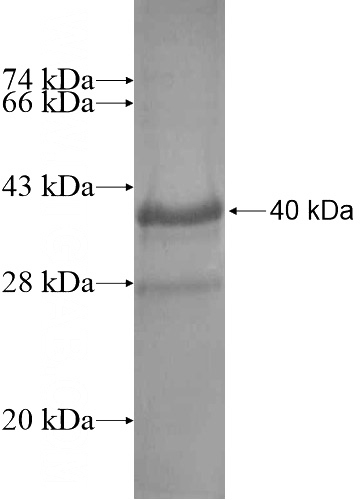 Recombinant Human UVRAG SDS-PAGE
