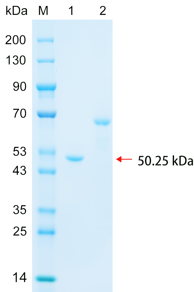 Recombinant M21D2 protein (His tag) SDS-PAGE