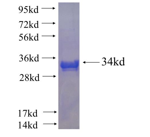 Recombinant human DNM1L,DLP1 SDS-PAGE