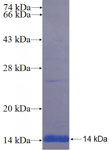 Recombinant Human SMPD3 SDS-PAGE