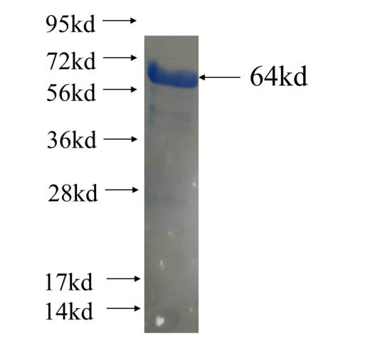 Recombinant human CKAP5 SDS-PAGE