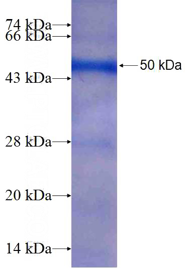Recombinant Human CYFIP2 SDS-PAGE