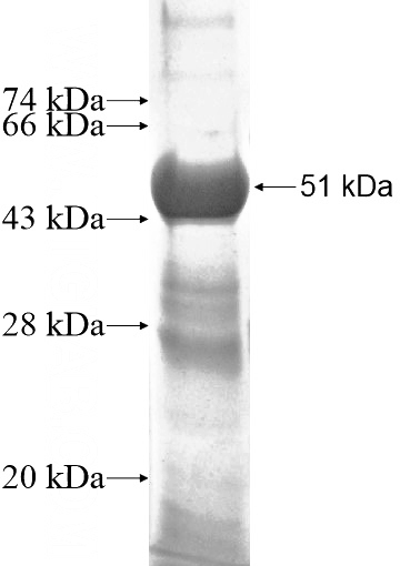 Recombinant Human CABP7 SDS-PAGE