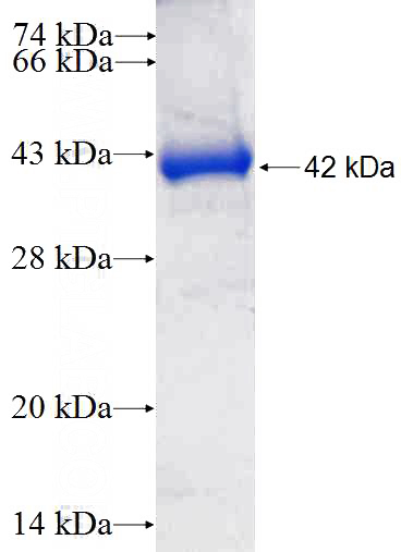 Recombinant Human COTL1 SDS-PAGE