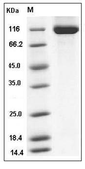 Human RET Kinase Protein (His Tag) SDS-PAGE