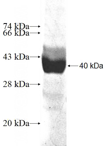 Recombinant Human LRRC8A SDS-PAGE