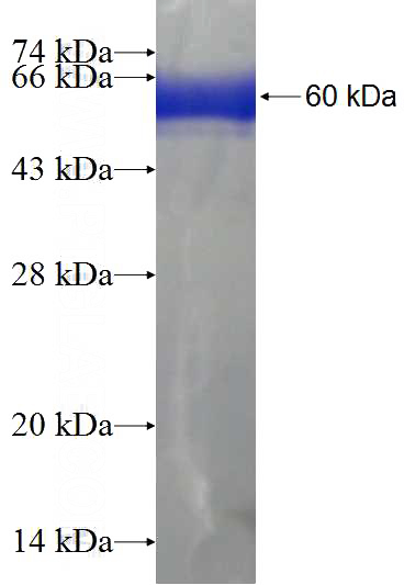 Recombinant Human STX4 SDS-PAGE
