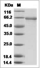 Influenza A H9N8 (A/chicken/Korea/164/04) Hemagglutinin / HA Protein (His Tag)