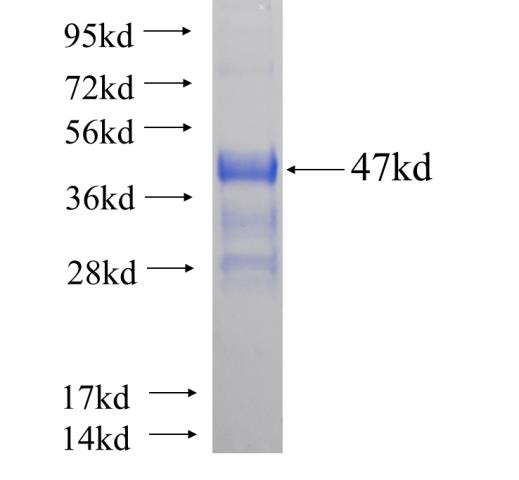 Recombinant human RFXAP SDS-PAGE