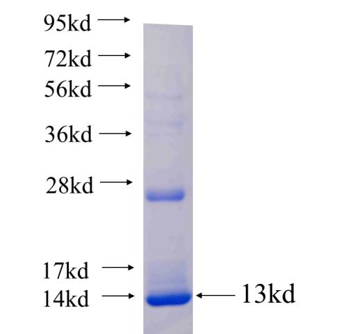 Recombinant human PPYR1 SDS-PAGE
