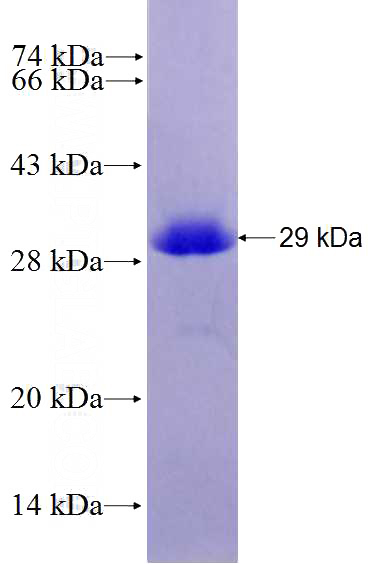 Recombinant Human HSPB1 SDS-PAGE