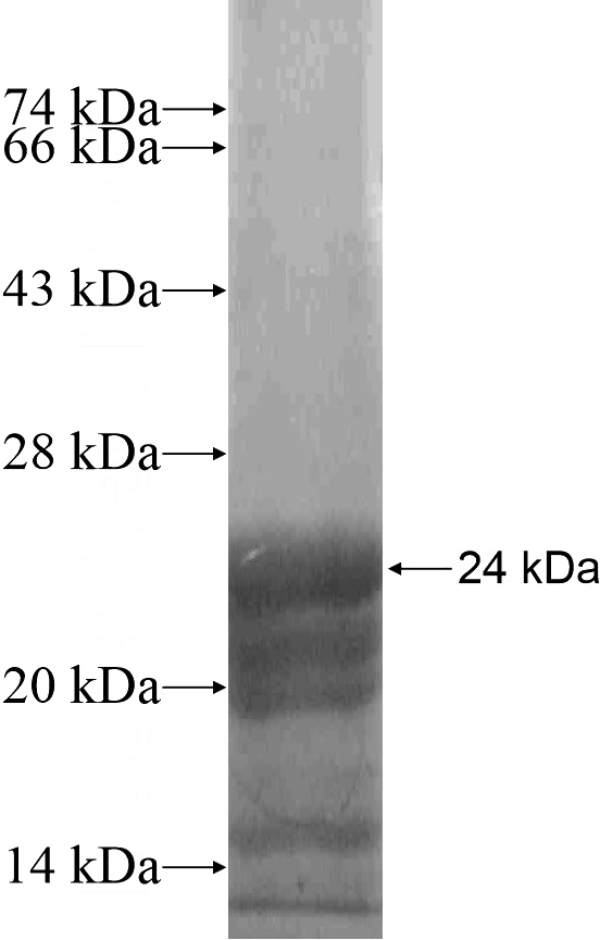 Recombinant Human TMEM132D SDS-PAGE