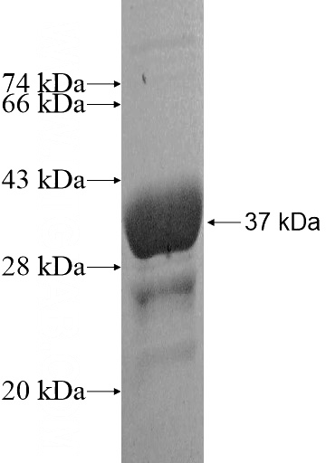 Recombinant Human NDUFB2 SDS-PAGE
