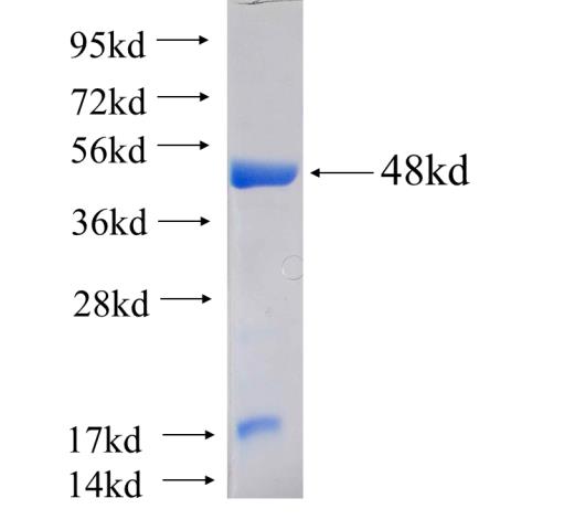 Recombinant human RAD51L1(Full length) SDS-PAGE