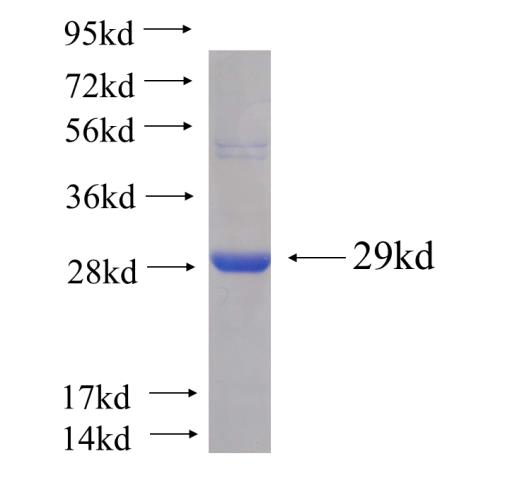 Recombinant human AANAT(Full length) SDS-PAGE