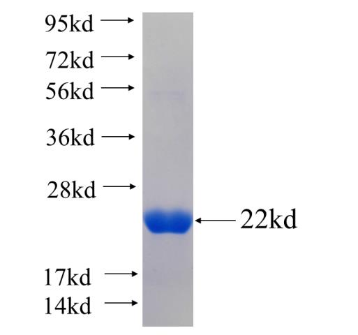 Recombinant human SLC22A5 SDS-PAGE