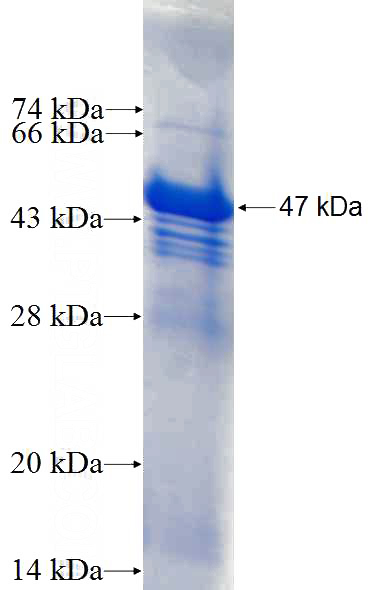 Recombinant Human ABI3BP SDS-PAGE