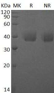 Human ANTXR1/ATR/TEM8 (His tag) recombinant protein