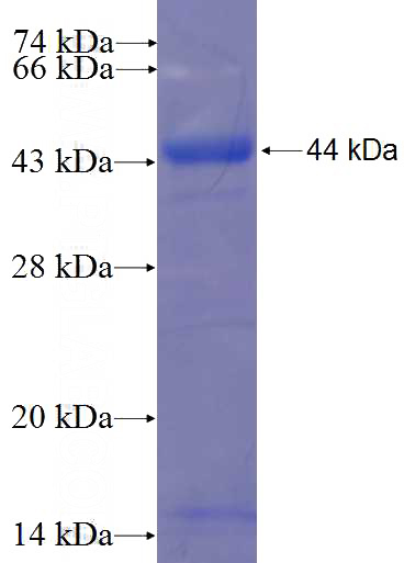Recombinant Human RBL1 SDS-PAGE