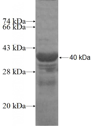 Recombinant Human COG6 SDS-PAGE