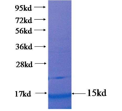 Recombinant human ASB5 SDS-PAGE