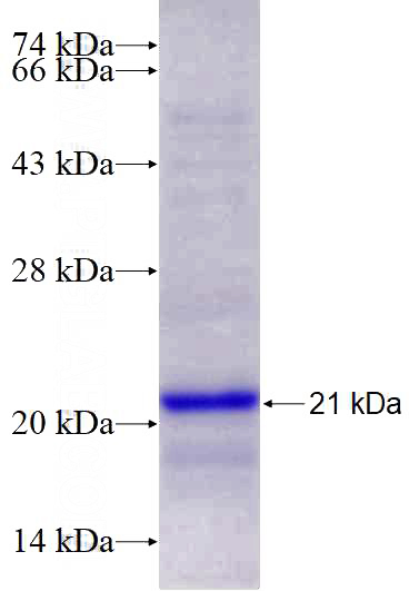 Recombinant Human DDX21 SDS-PAGE