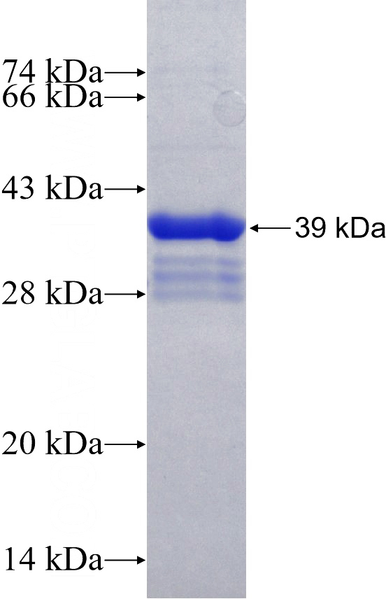 Recombinant Human NANOG SDS-PAGE