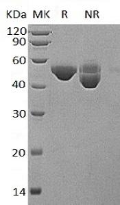 Human B4GAT1/B3GNT1/B3GNT6 (His tag) recombinant protein